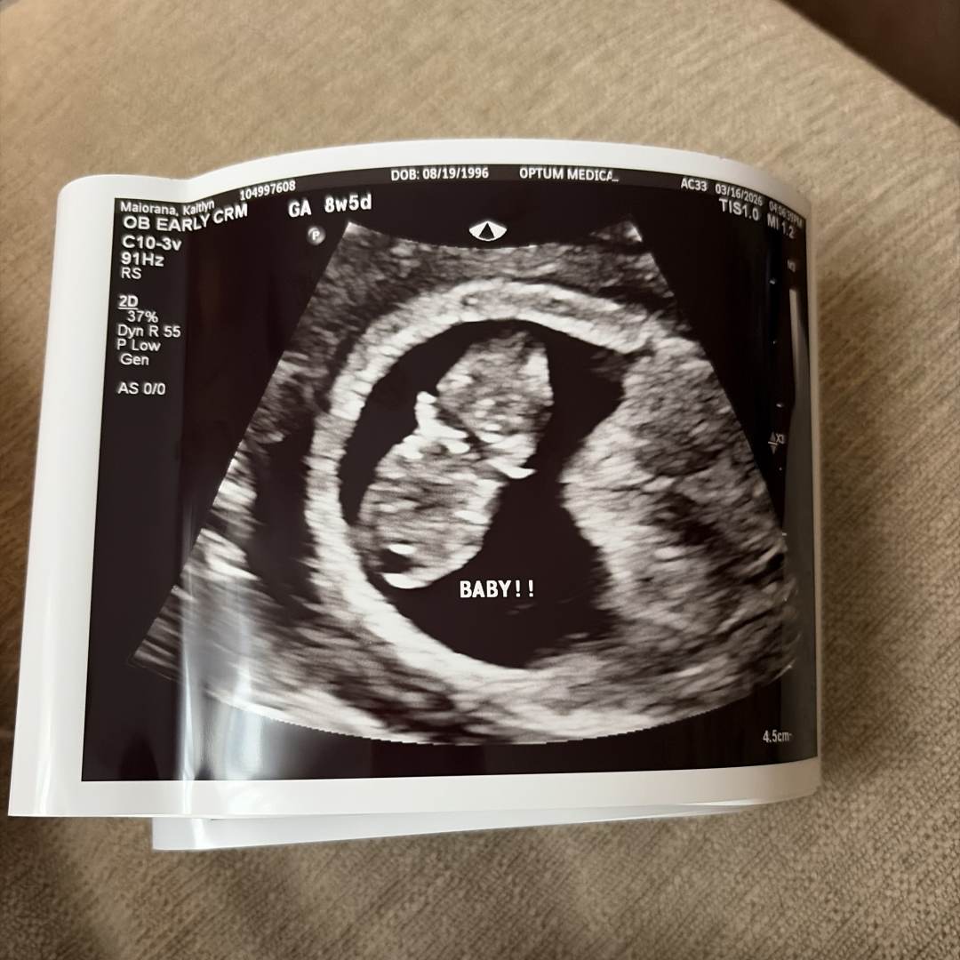 Photo shared by Katie for their Babylist baby registry.