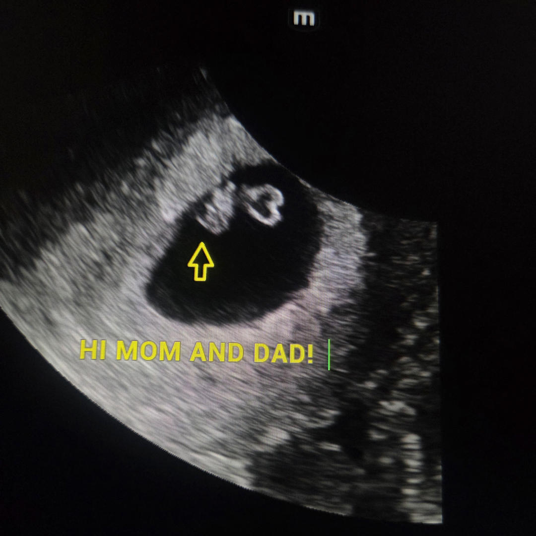 Photo shared by Julia for their Babylist baby registry.