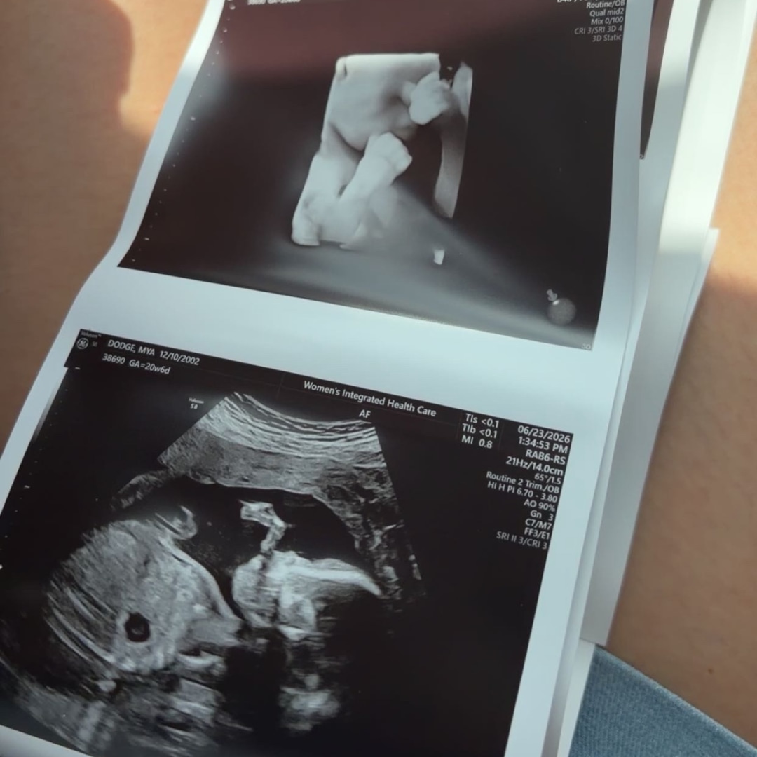 Photo shared by Mya for their Babylist baby registry.