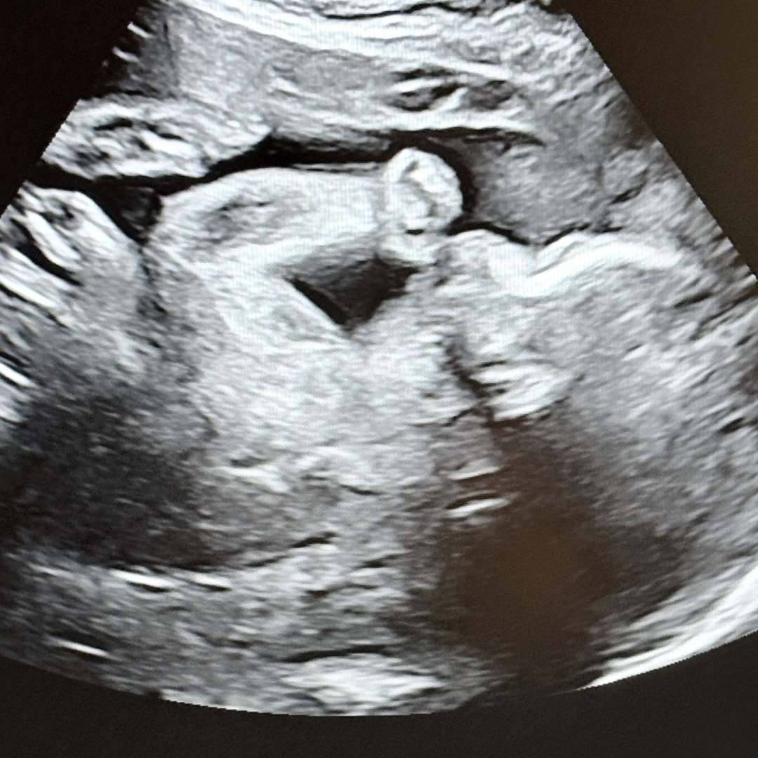 Photo shared by Adrianna for their Babylist baby registry.
