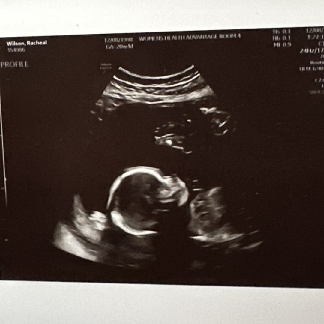 Photo shared by Racheal for their Babylist baby registry.