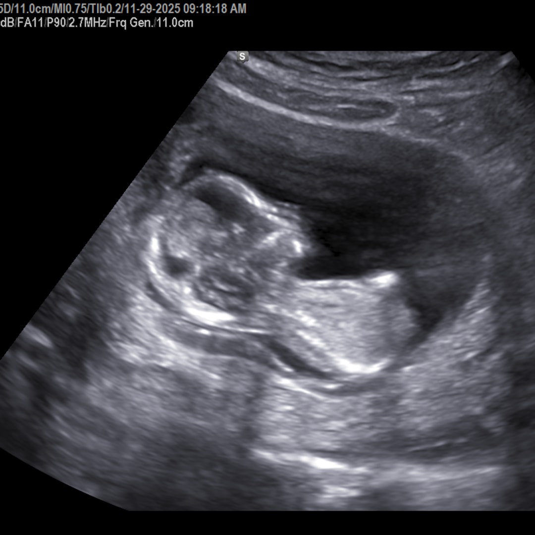 Photo shared by Catherine for their Babylist baby registry.