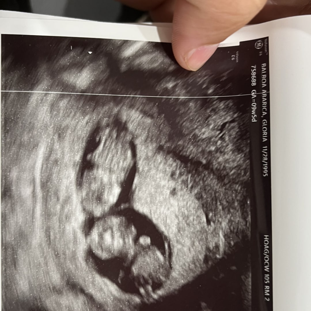 Photo shared by Gloria for their Babylist baby registry.