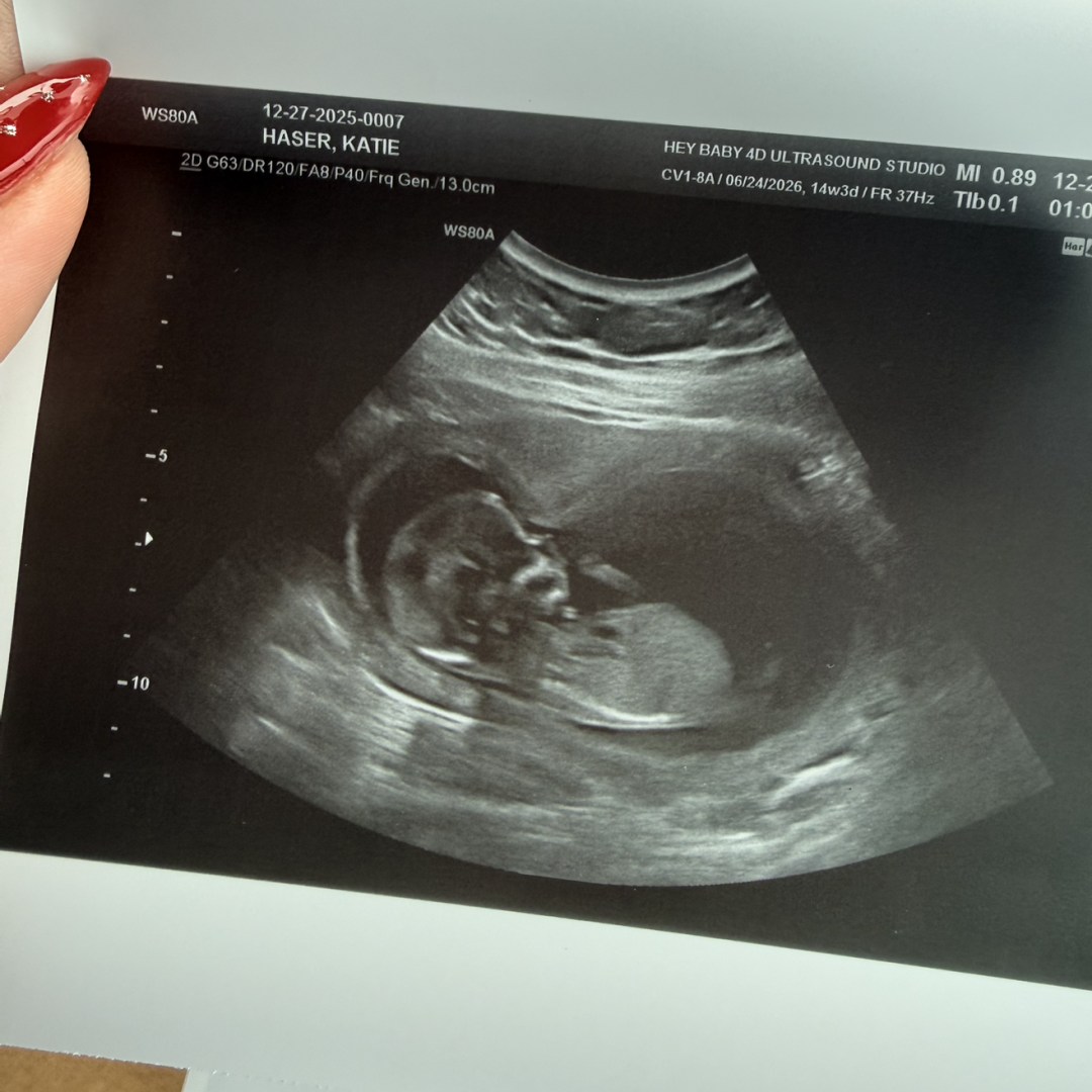 Photo shared by Katie for their Babylist baby registry.