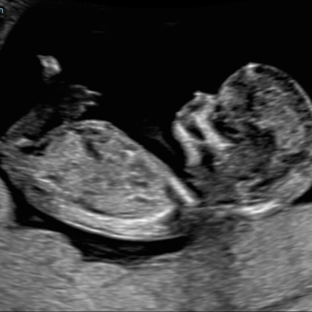 Photo shared by Brooke for their Babylist baby registry.