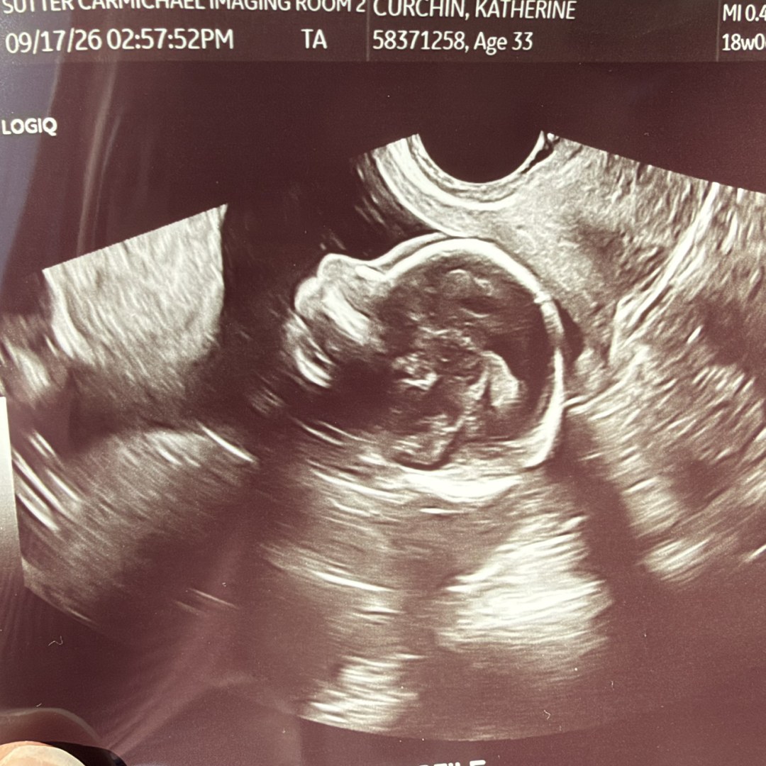 Photo shared by Kate for their Babylist baby registry.