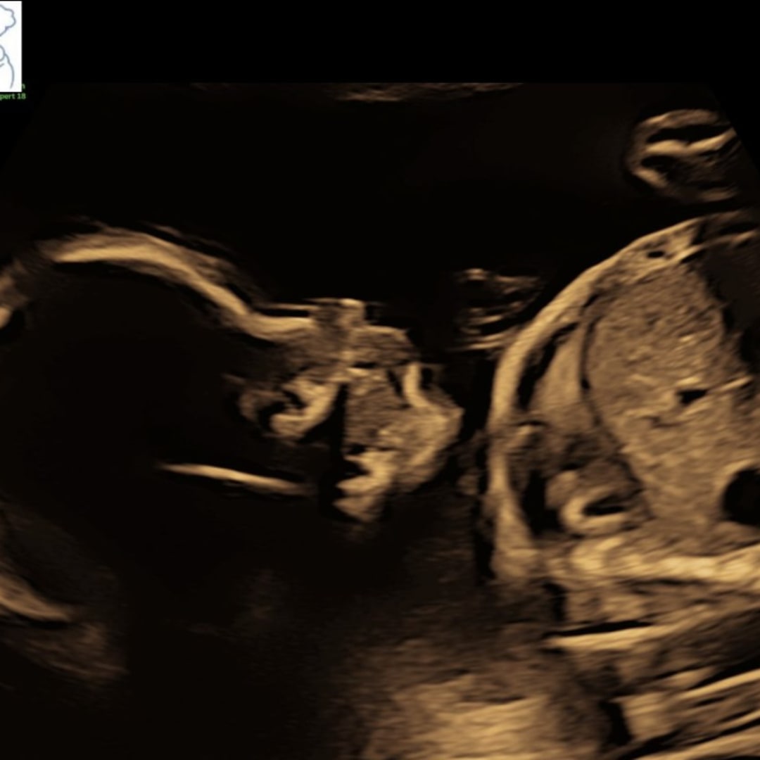 Photo shared by Amanda for their Babylist baby registry.