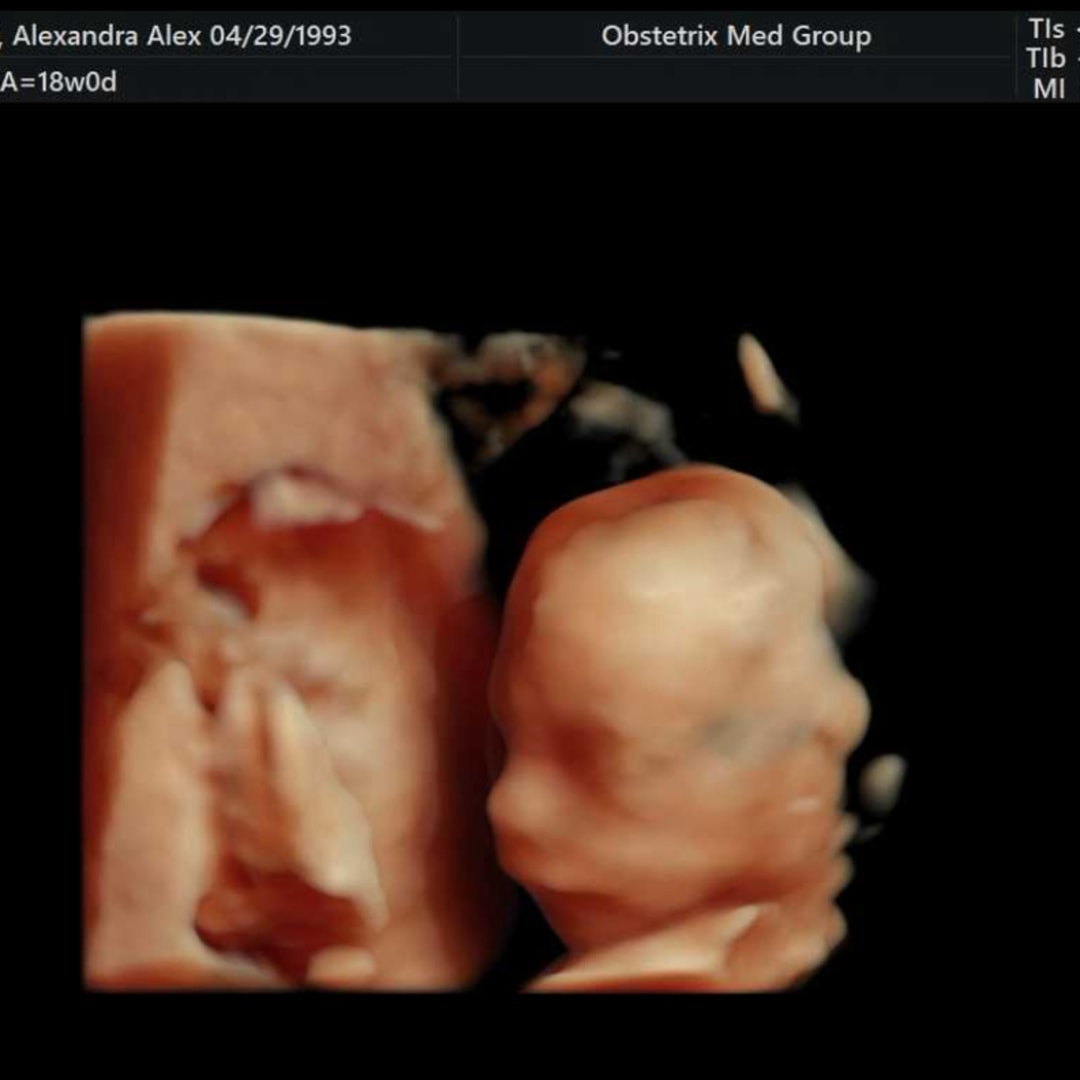 Photo shared by Alex for their Babylist baby registry.