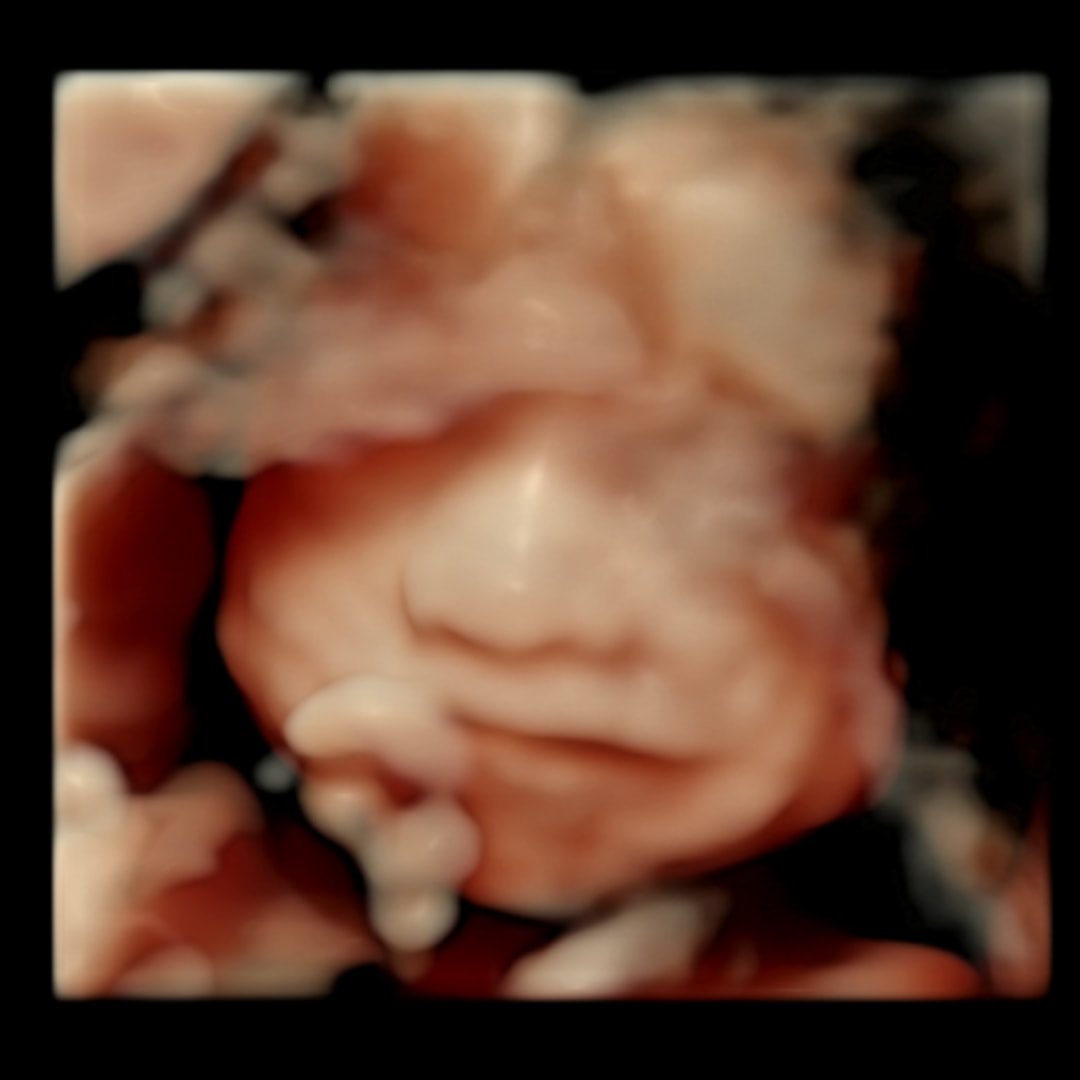 Photo shared by Jacqueline for their Babylist baby registry.