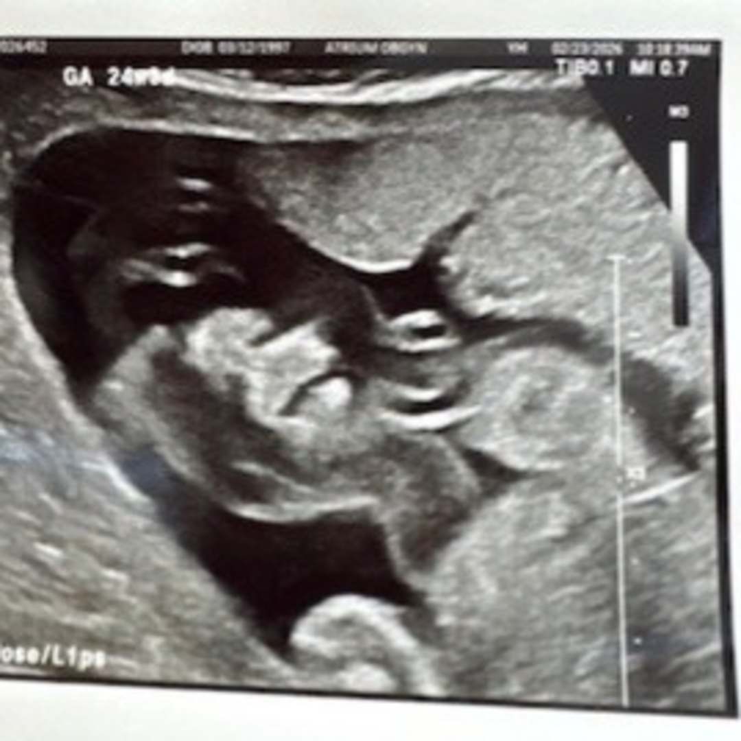 Photo shared by Hannah for their Babylist baby registry.