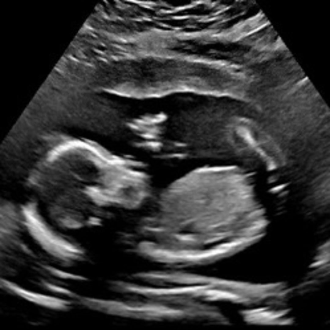 Photo shared by Chloe-Rose for their Babylist baby registry.