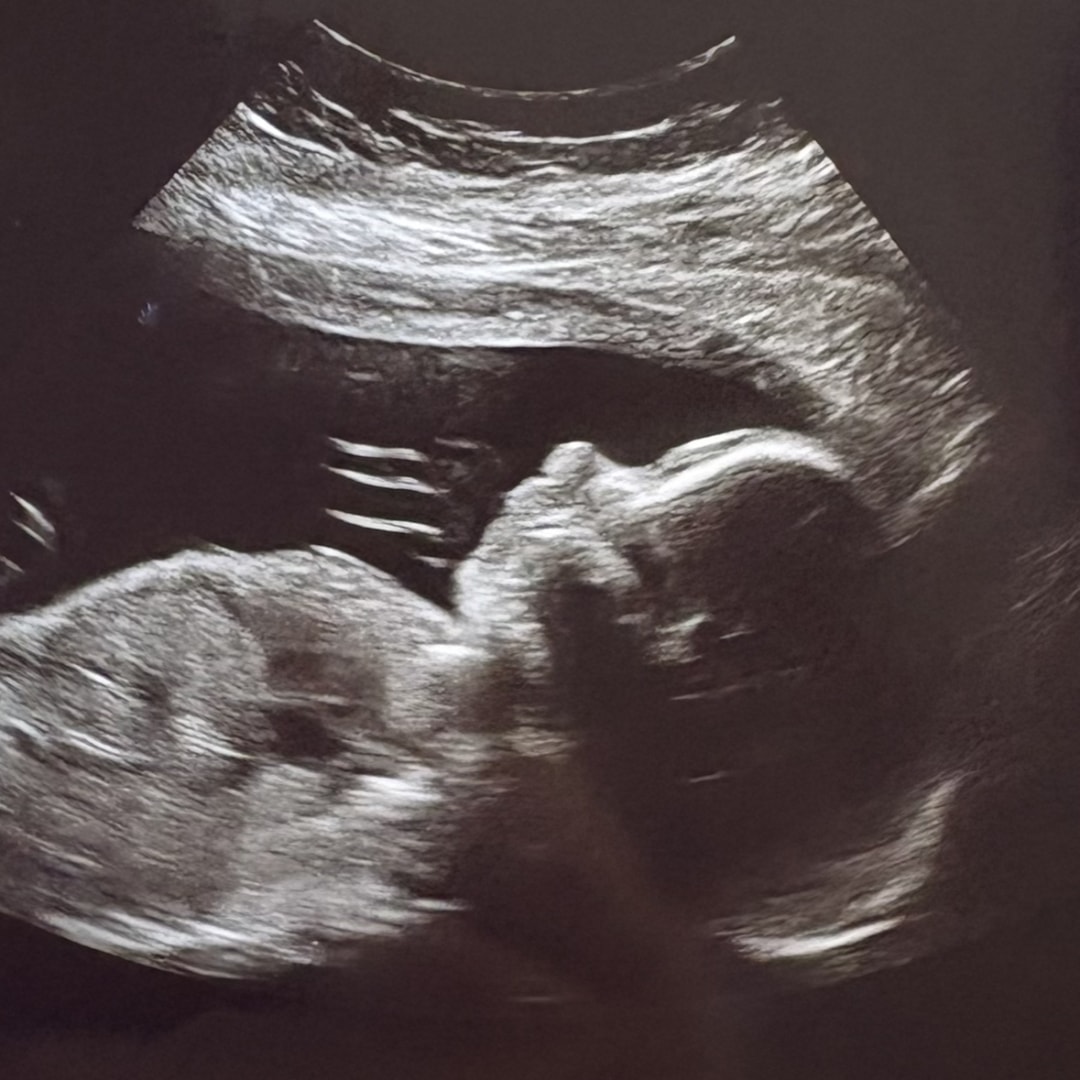 Photo shared by Madison for their Babylist baby registry.