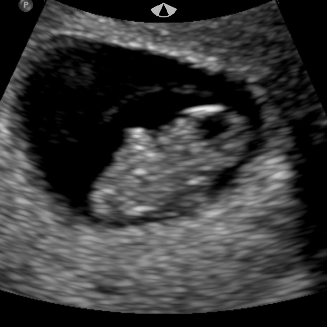 Photo shared by Kalley for their Babylist baby registry.
