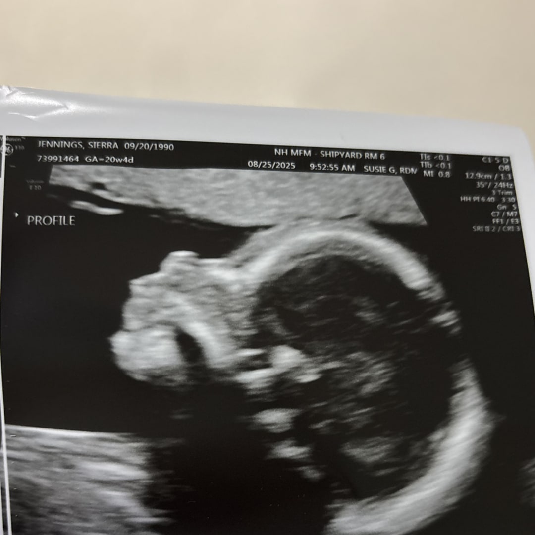 Photo shared by Sierra for their Babylist baby registry.