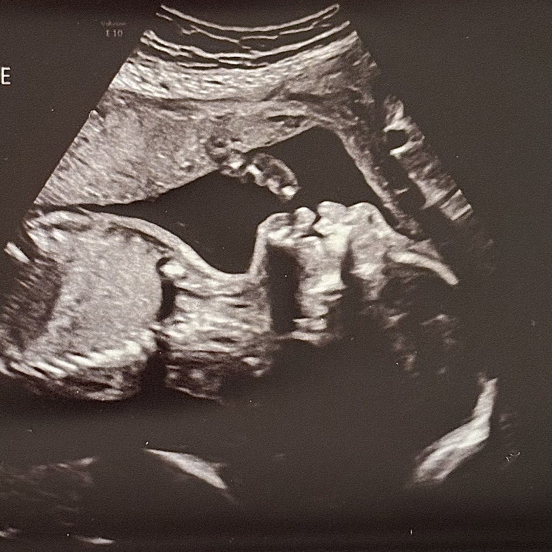 Photo shared by Kala for their Babylist baby registry.