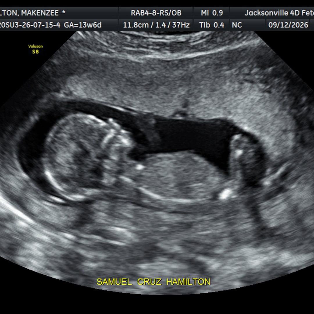 Photo shared by Makenzee for their Babylist baby registry.