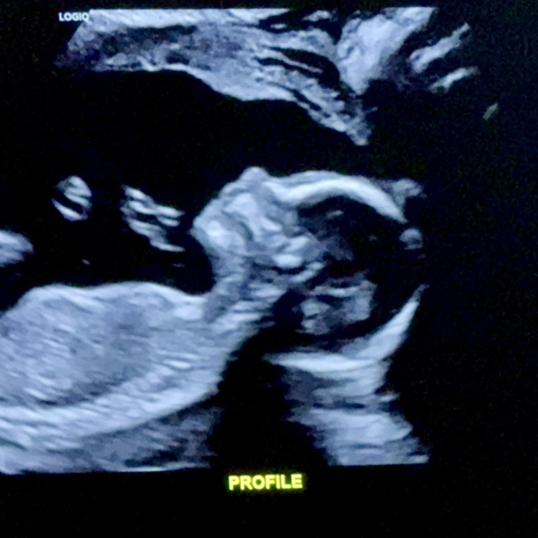 Photo shared by Brittany for their Babylist baby registry.