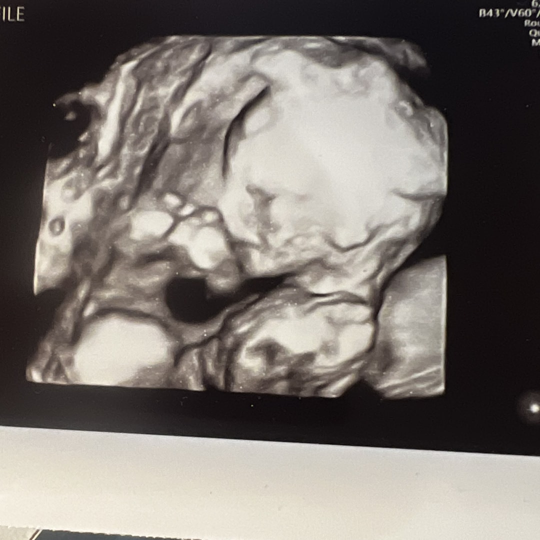 Photo shared by Jamie for their Babylist baby registry.