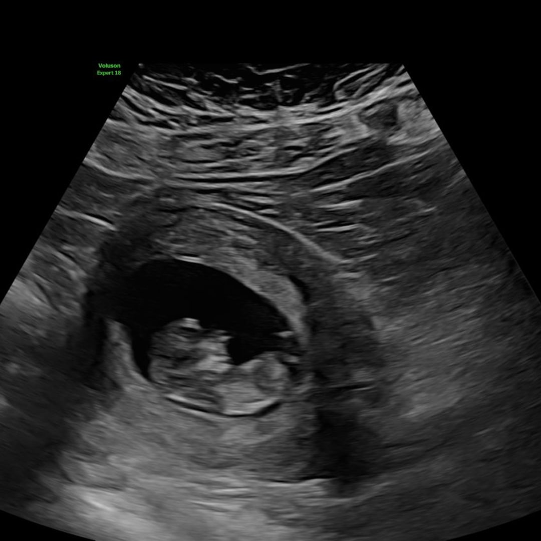 Photo shared by Ana for their Babylist baby registry.