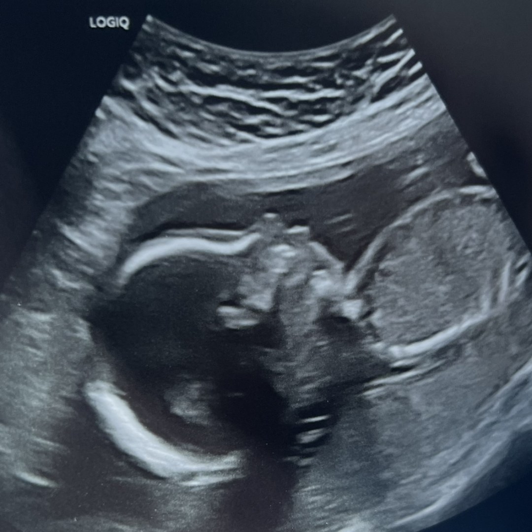 Photo shared by Kayden for their Babylist baby registry.