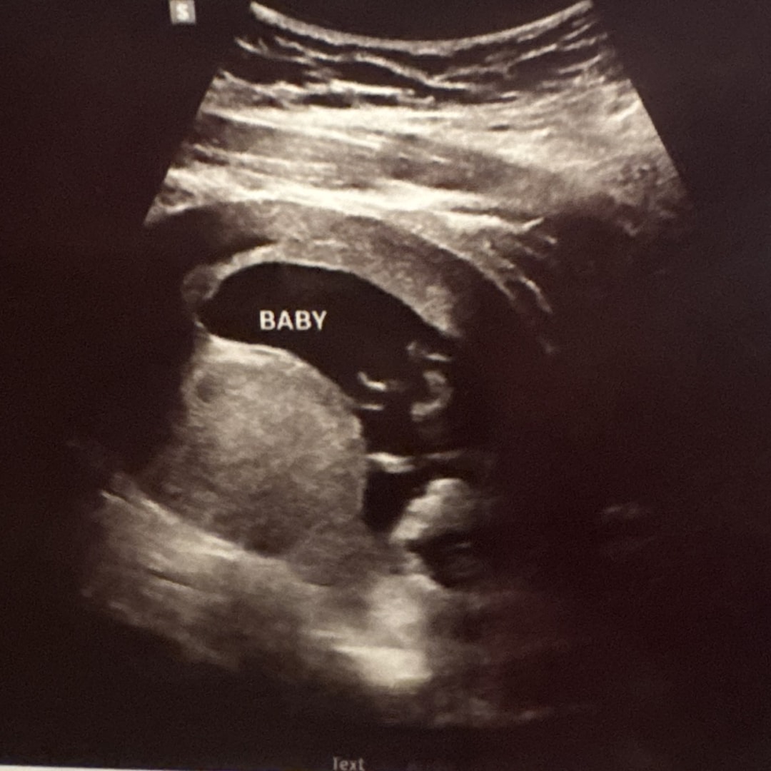 Photo shared by Jaleesa for their Babylist baby registry.