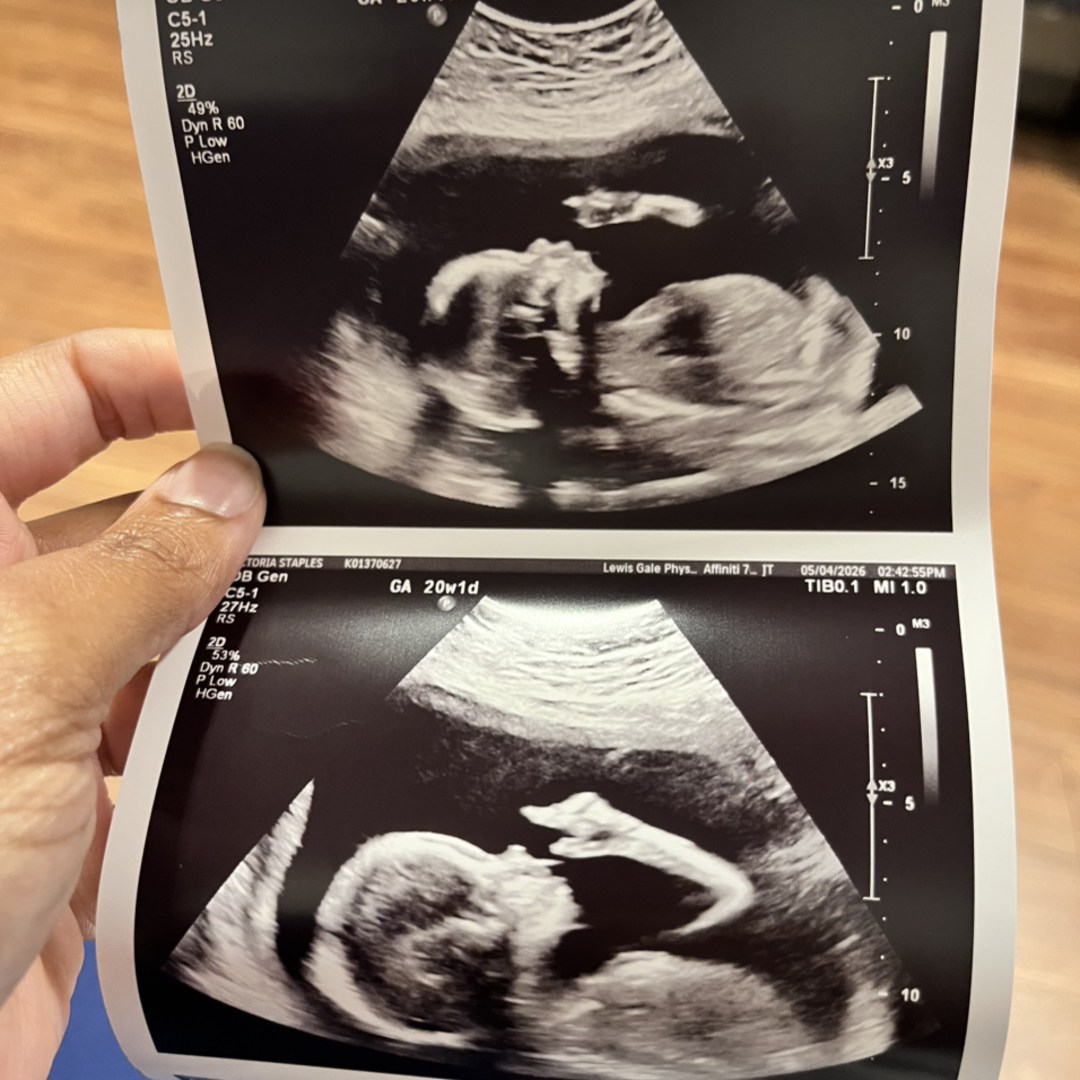 Photo shared by Victoria for their Babylist baby registry.