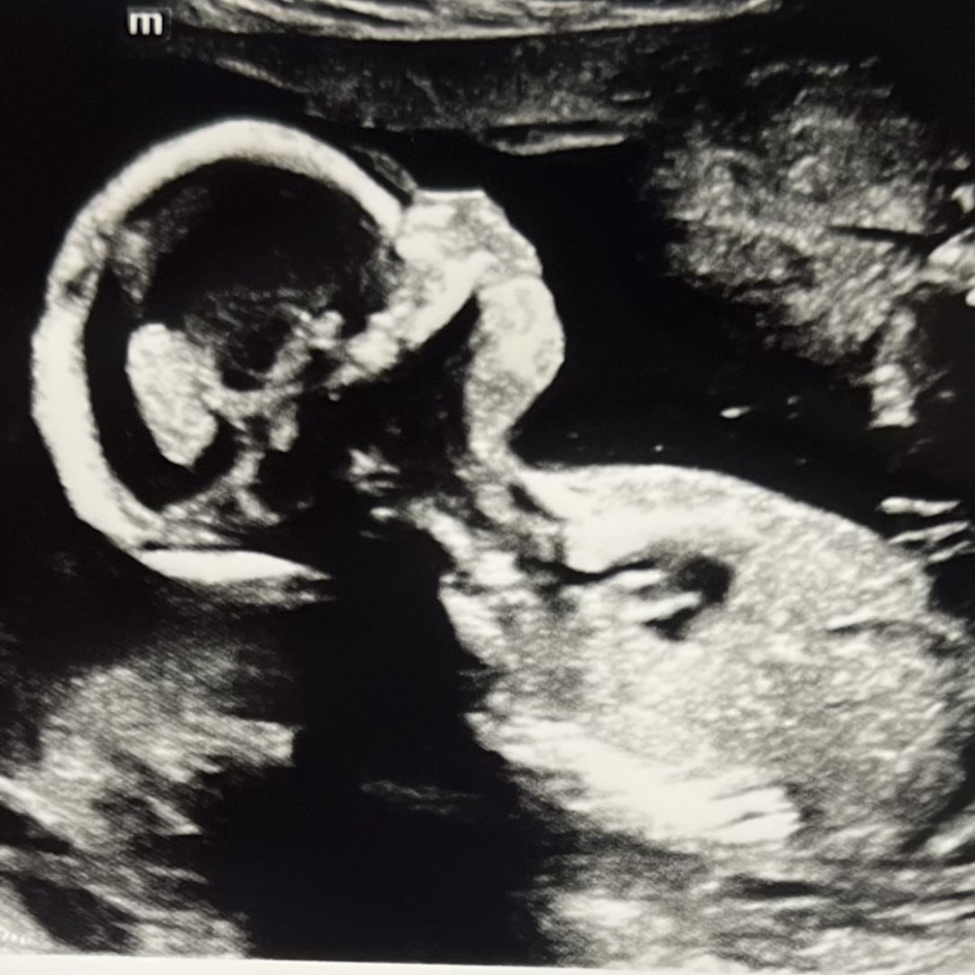 Photo shared by Ashley for their Babylist baby registry.