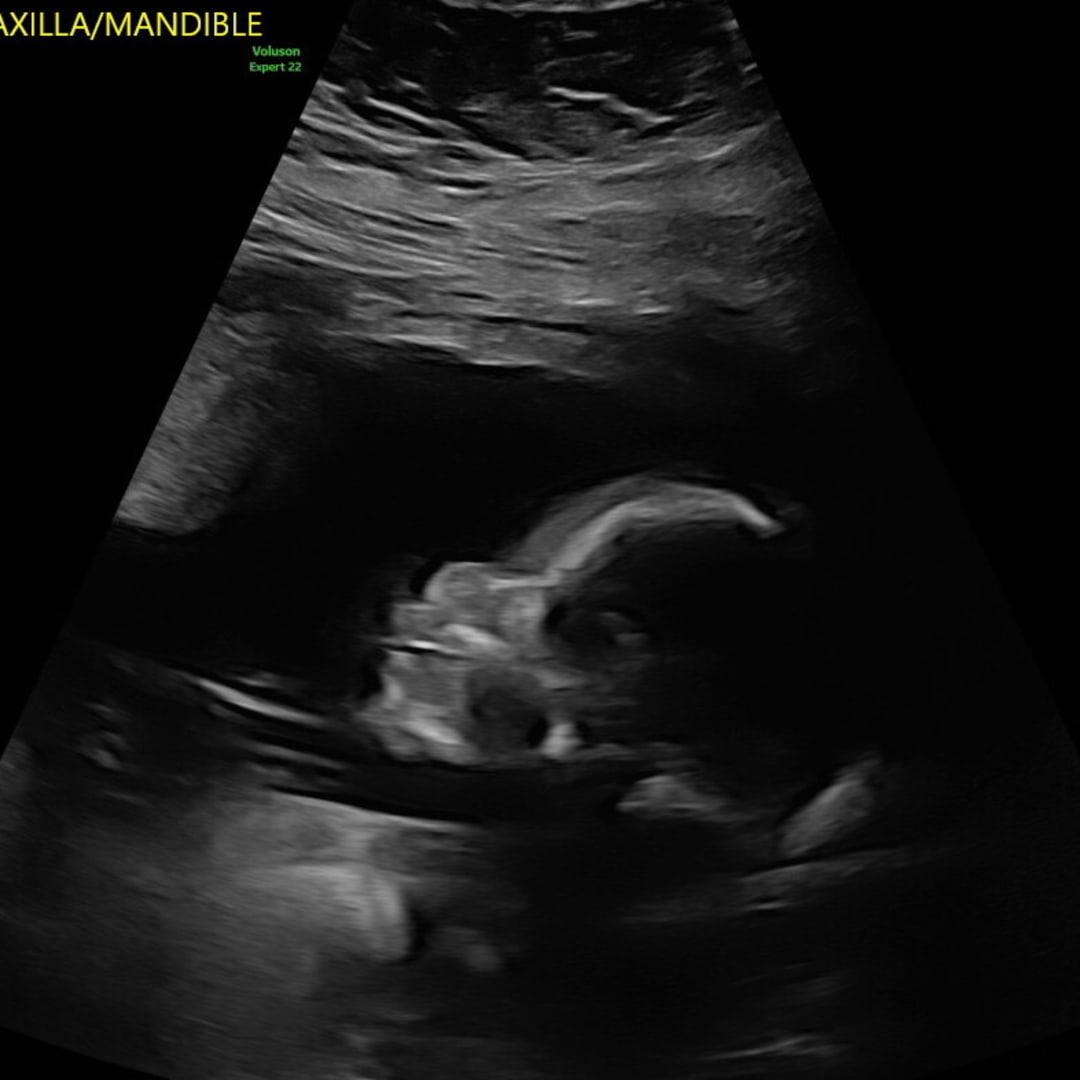 Photo shared by Marie Lizsly for their Babylist baby registry.