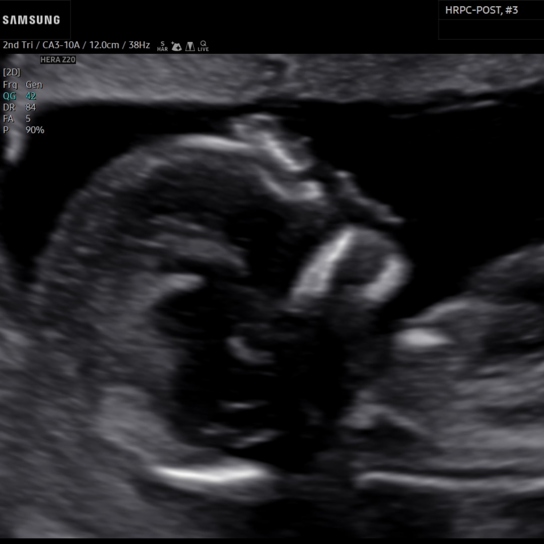 Photo shared by Marcus for their Babylist baby registry.