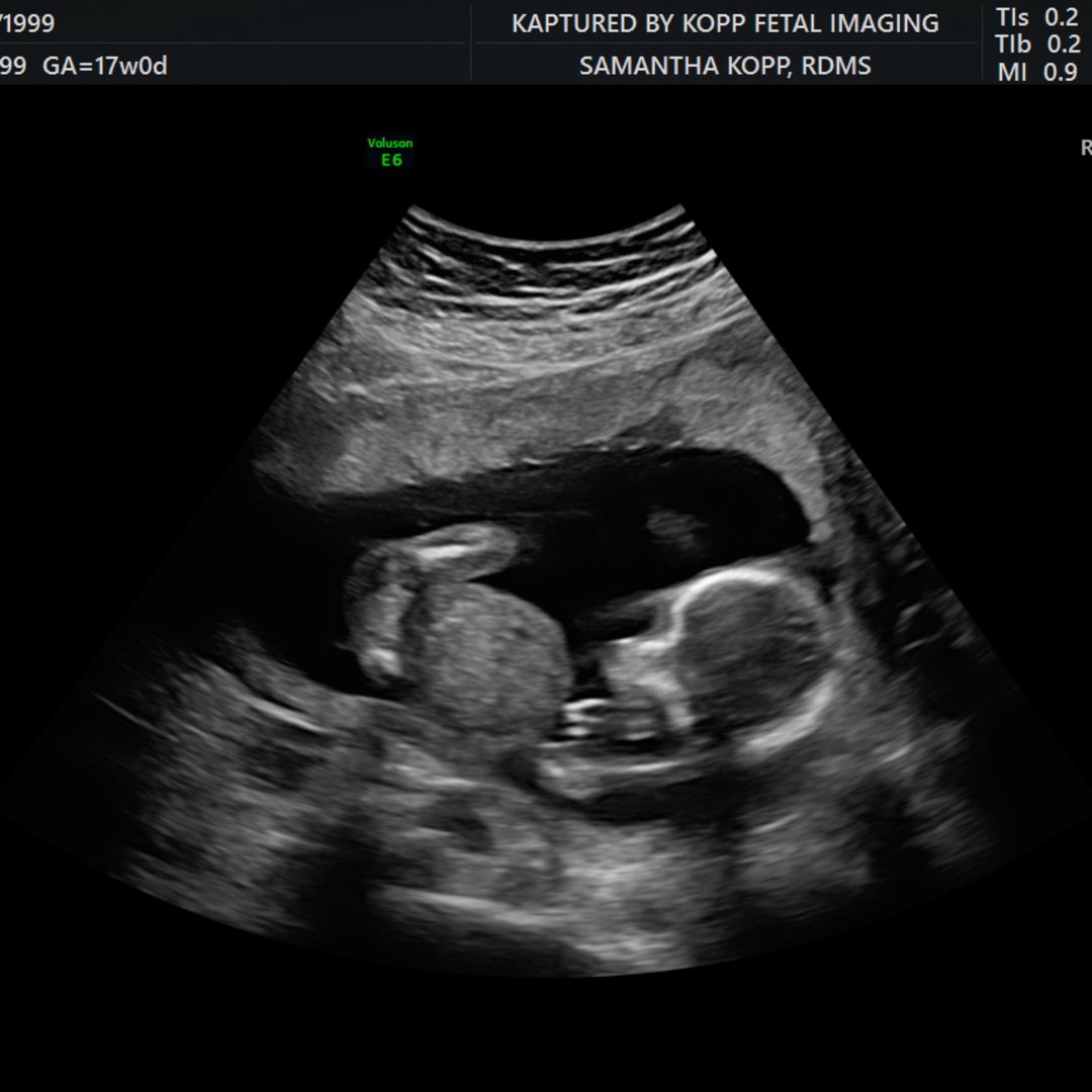 Photo shared by Gina for their Babylist baby registry.