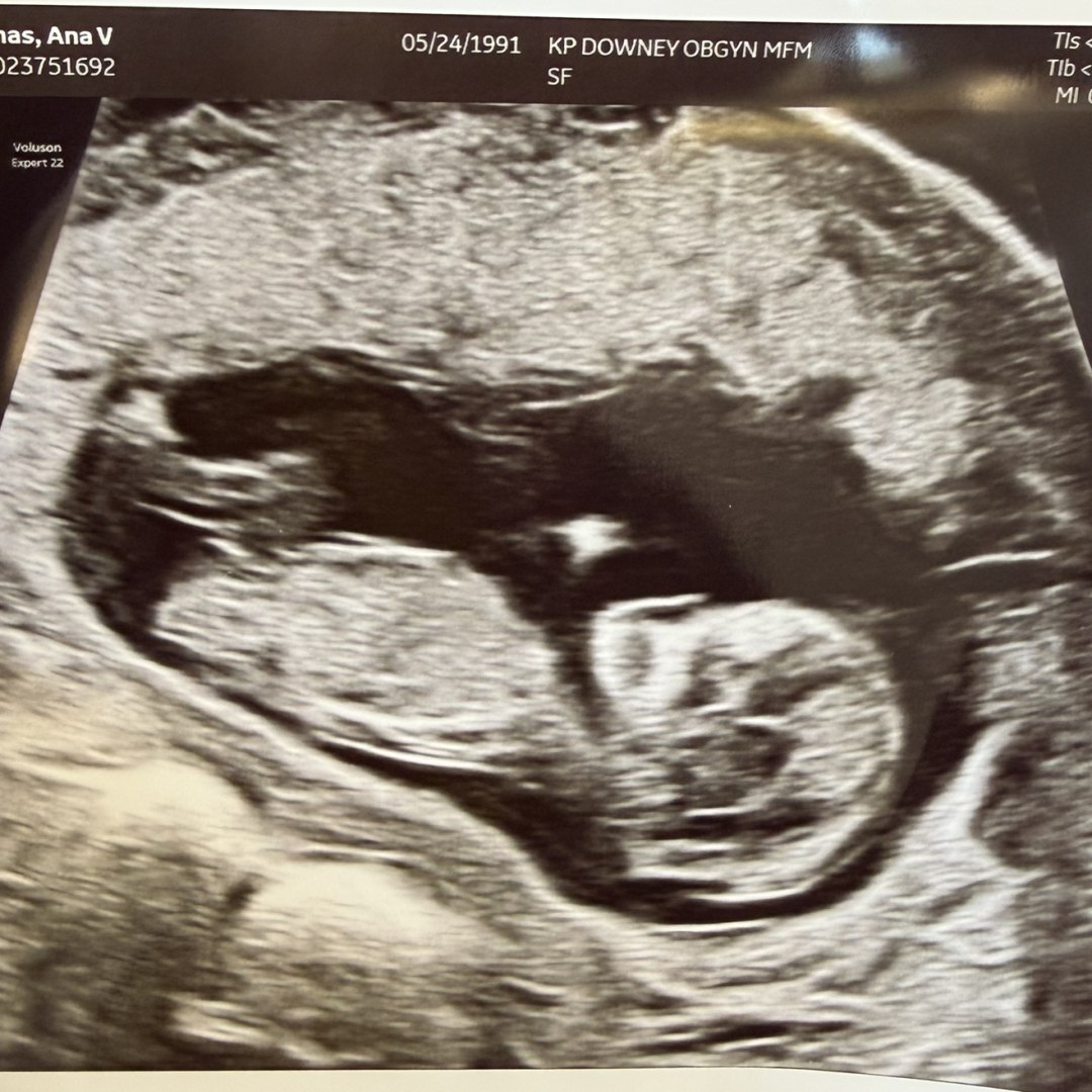 Photo shared by Ana for their Babylist baby registry.