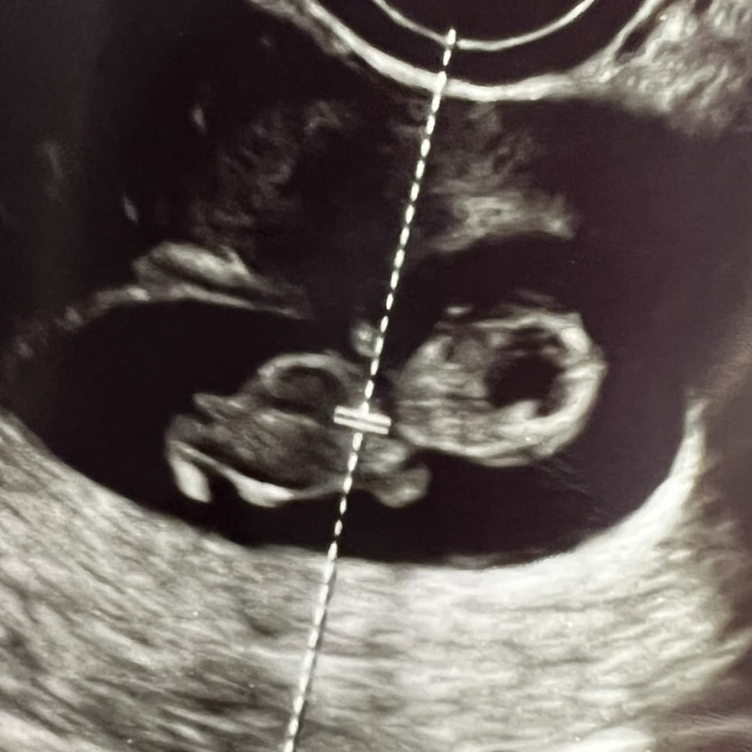 Photo shared by Brianna for their Babylist baby registry.
