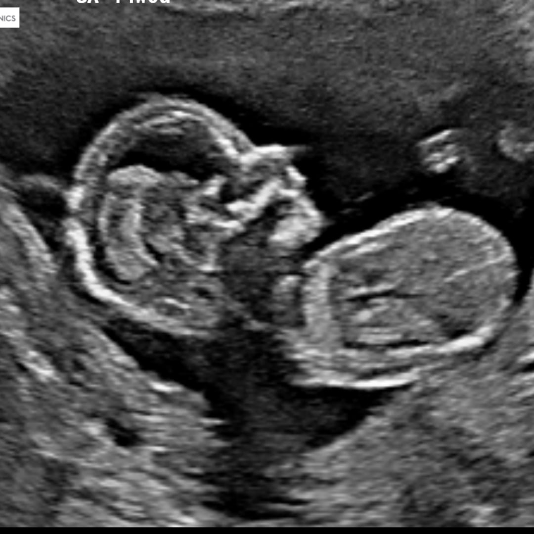 Photo shared by Carolyn for their Babylist baby registry.