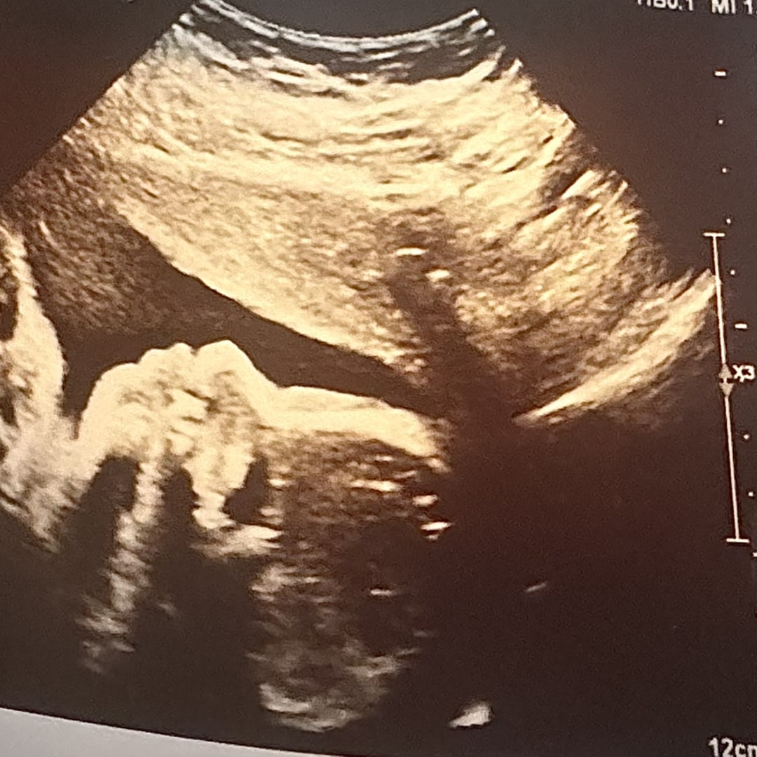 Photo shared by Thea for their Babylist baby registry.