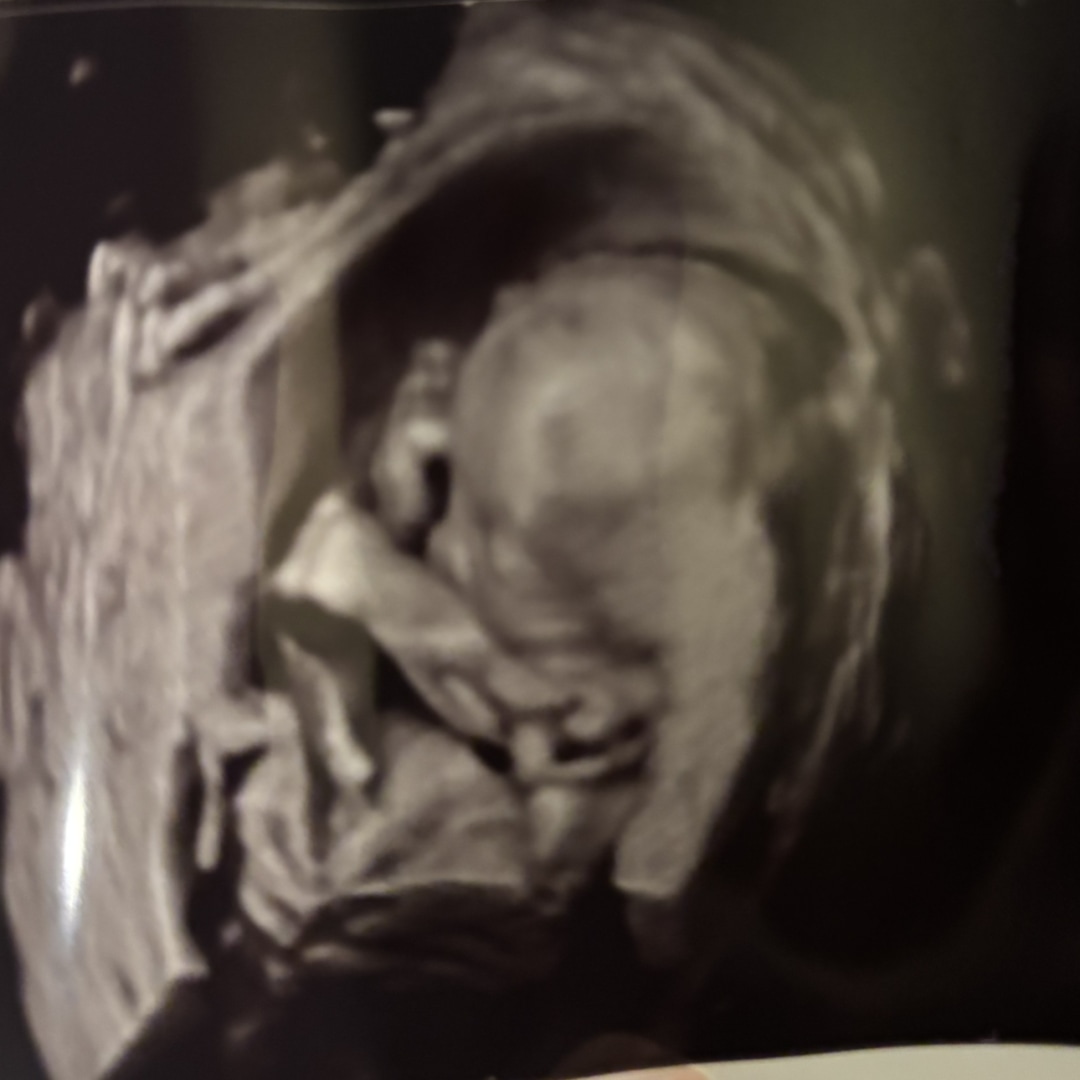 Photo shared by Lily for their Babylist baby registry.