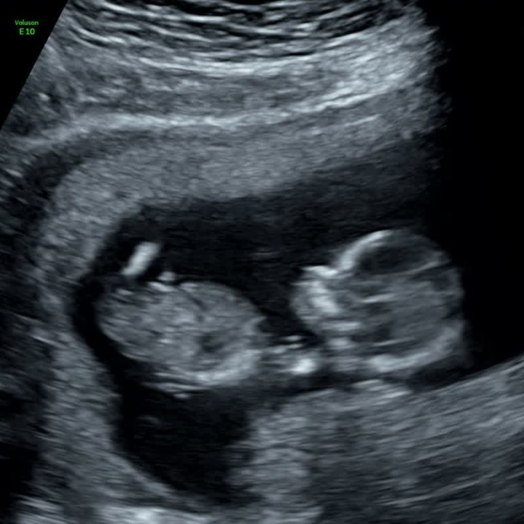 Photo shared by Joule for their Babylist baby registry.