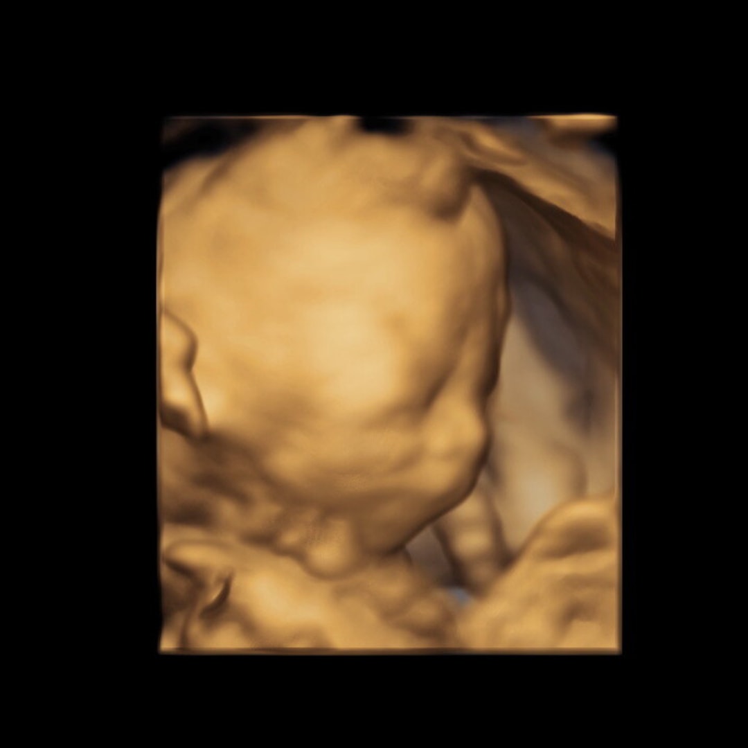 Photo shared by Emily for their Babylist baby registry.