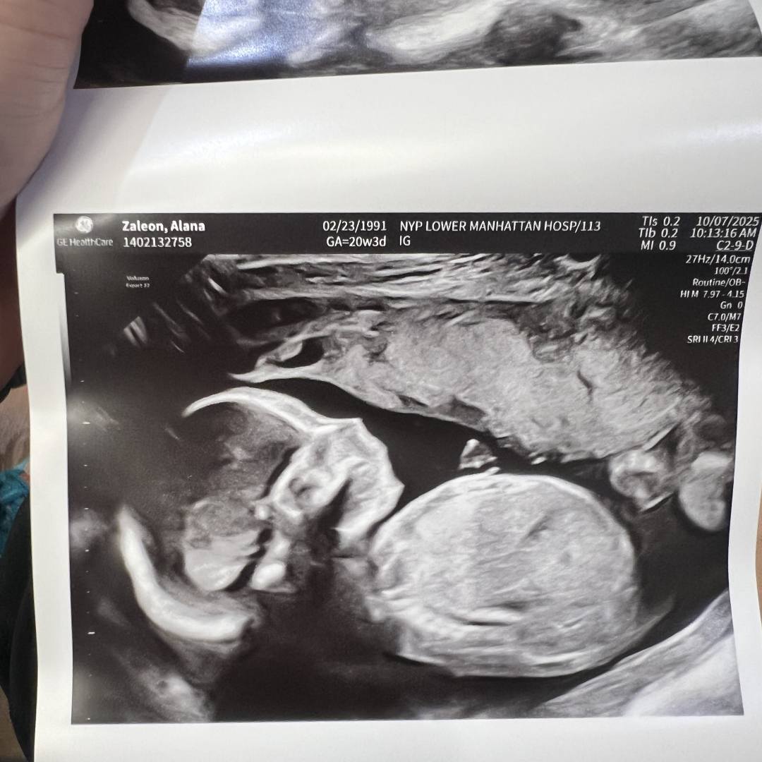 Photo shared by Alana for their Babylist baby registry.