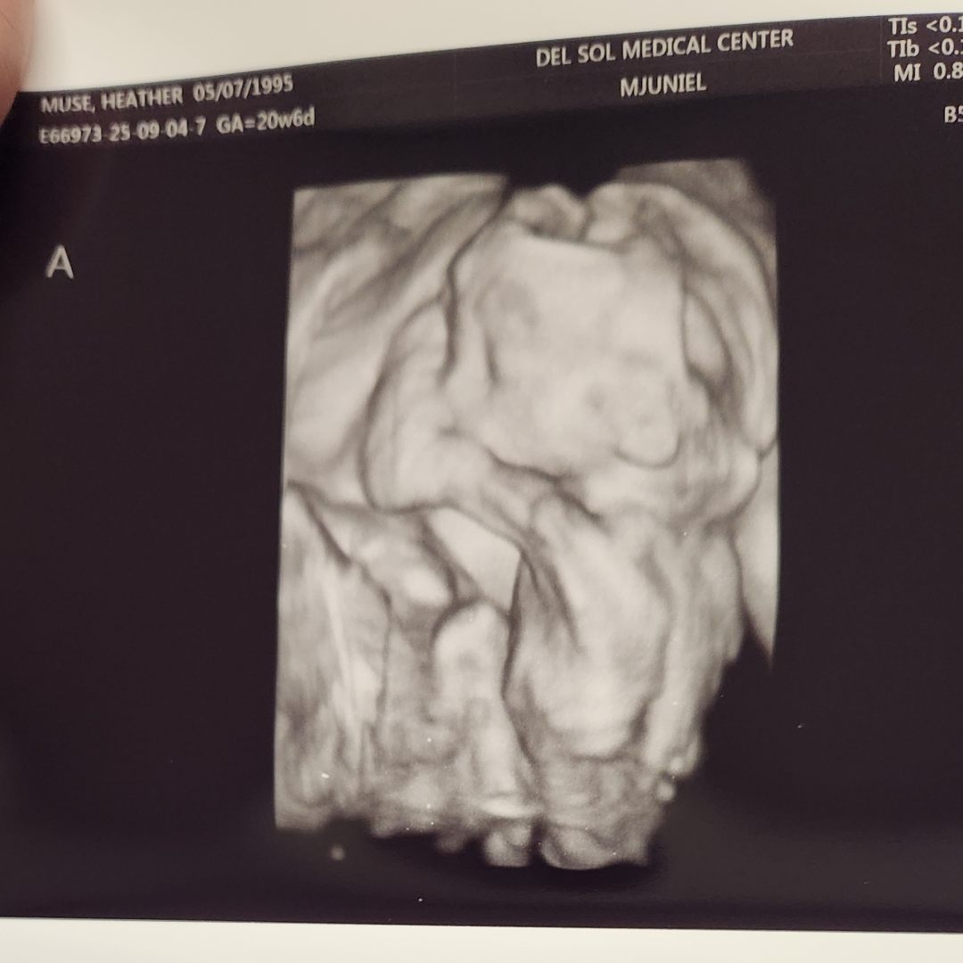 Photo shared by Heather for their Babylist baby registry.