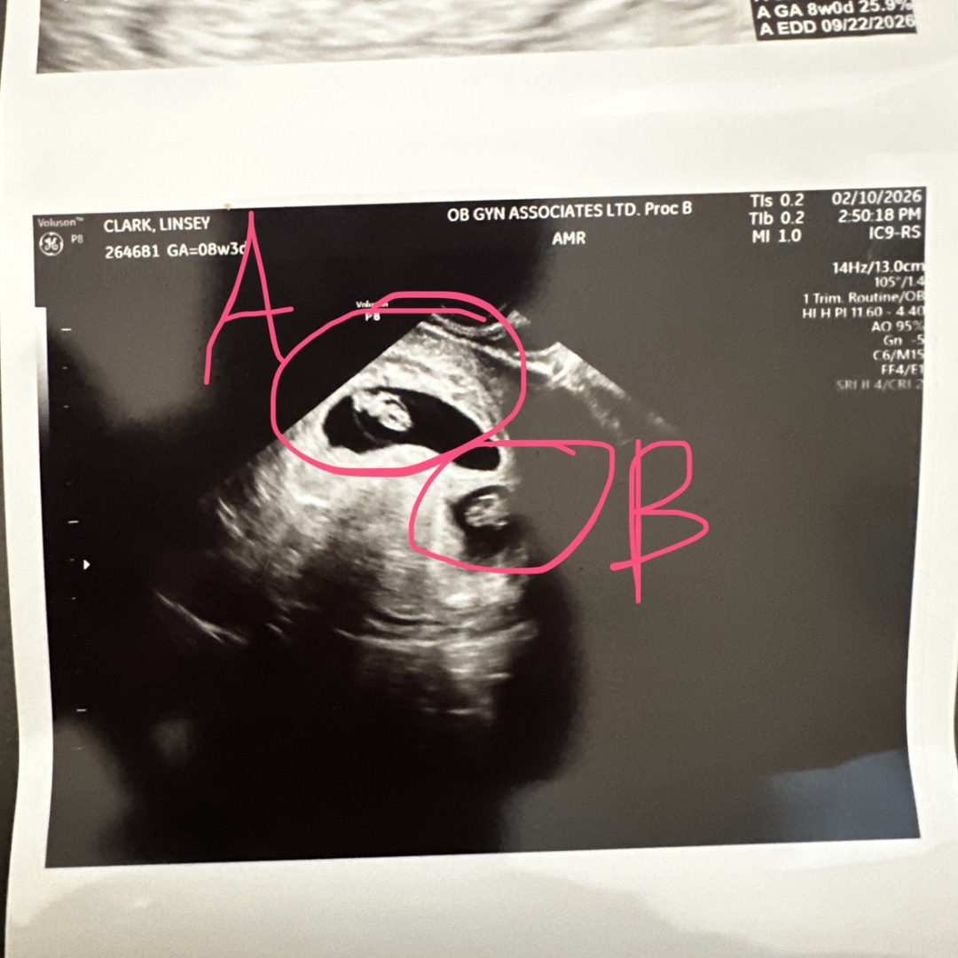 Photo shared by Linsey for their Babylist baby registry.