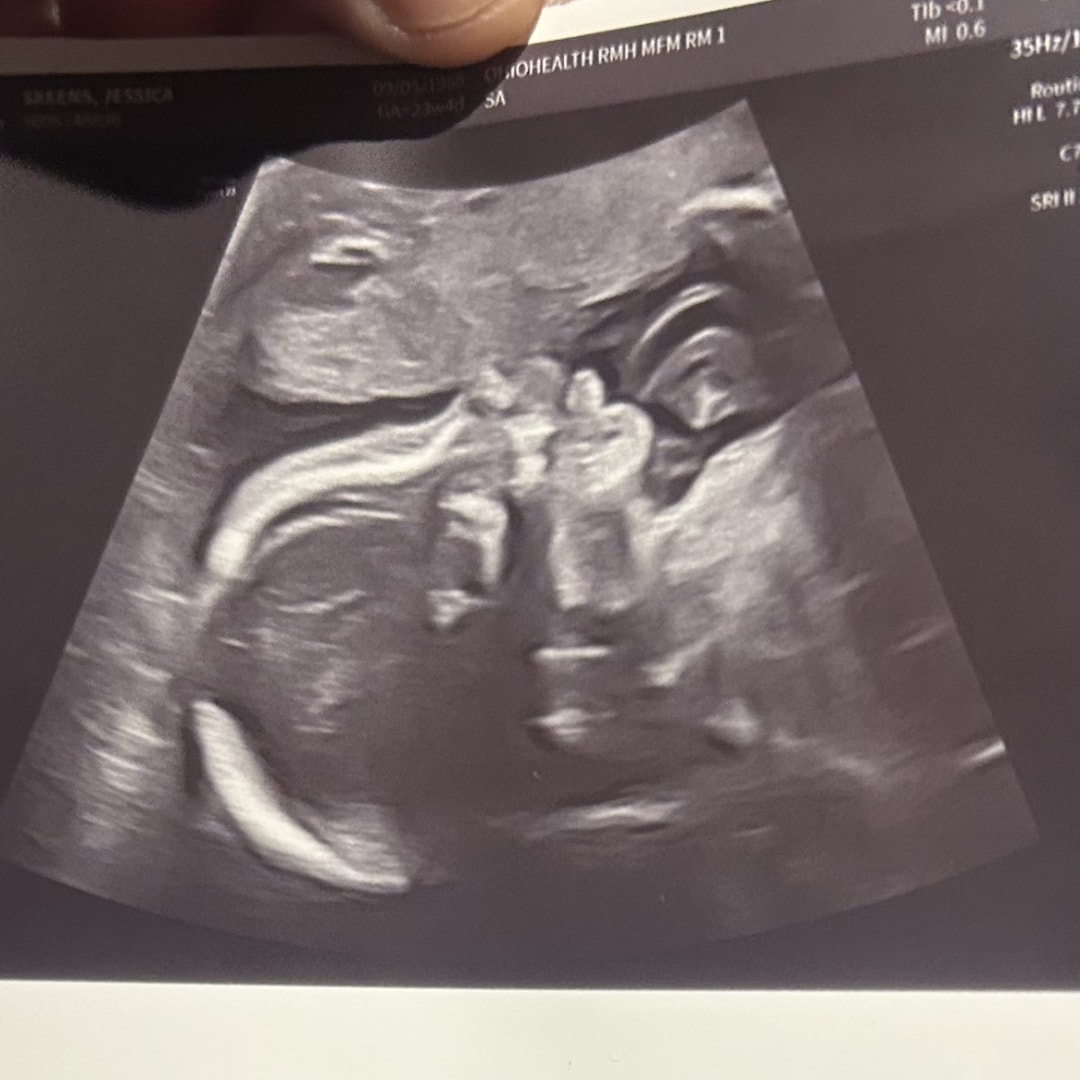 Photo shared by Jessica for their Babylist baby registry.