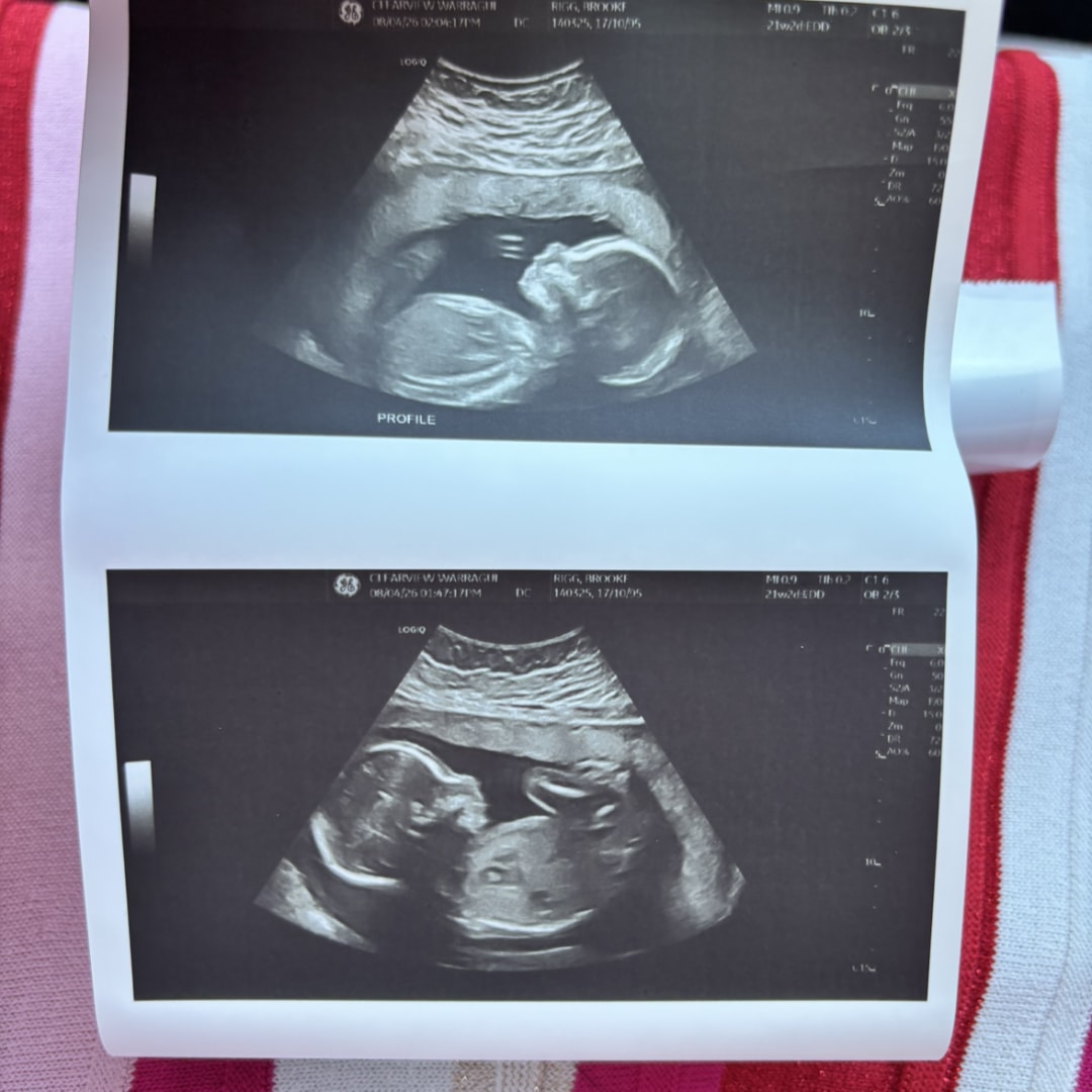 Photo shared by Brooke for their Babylist baby registry.