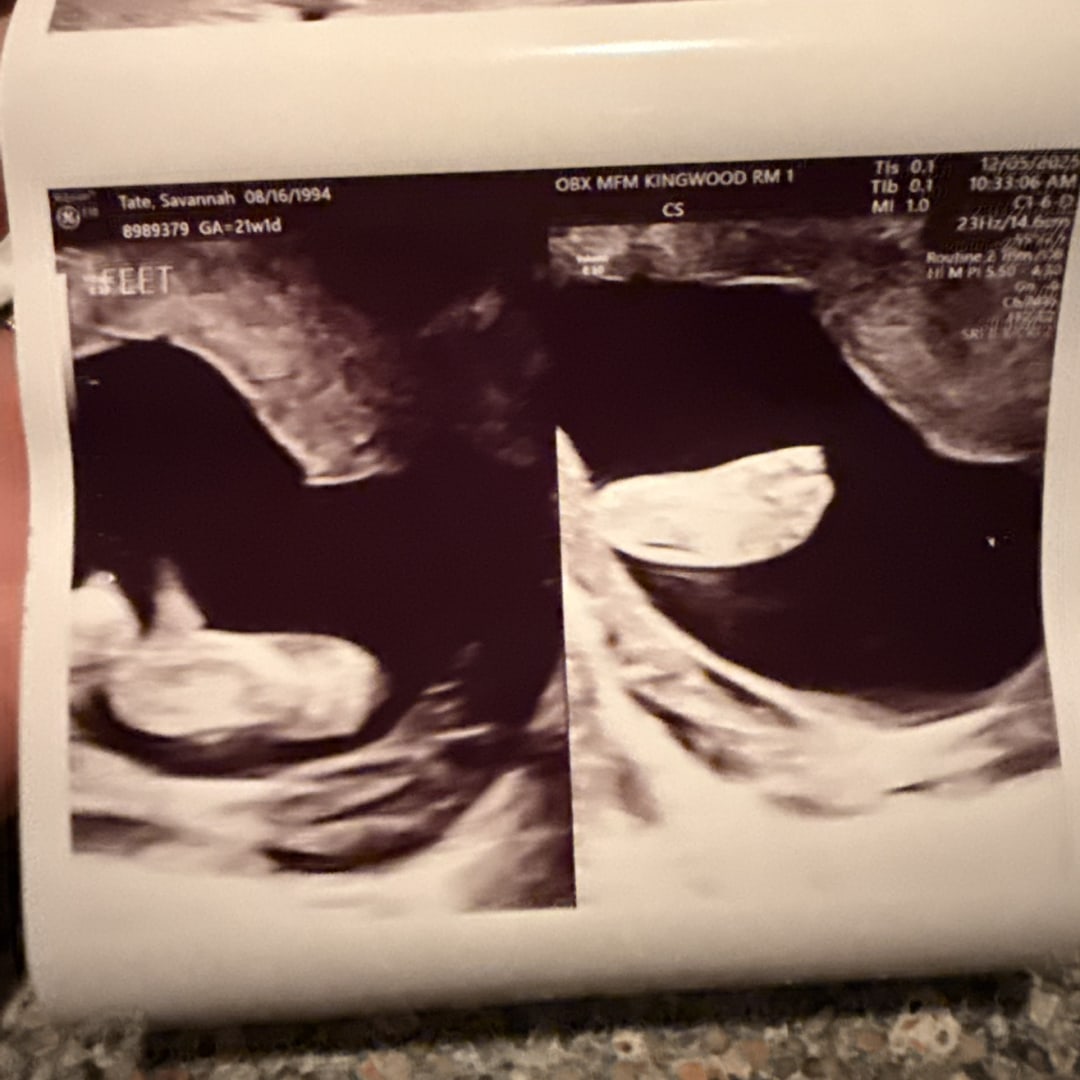 Photo shared by Savannah for their Babylist baby registry.