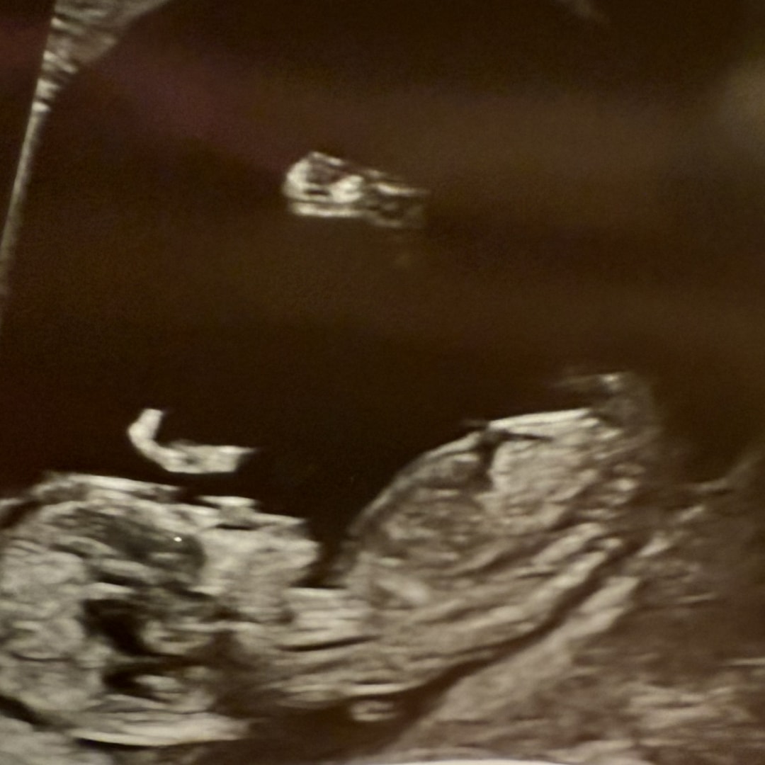 Photo shared by Haley for their Babylist baby registry.