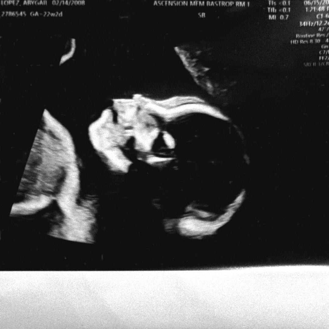 Photo shared by Abygail for their Babylist baby registry.