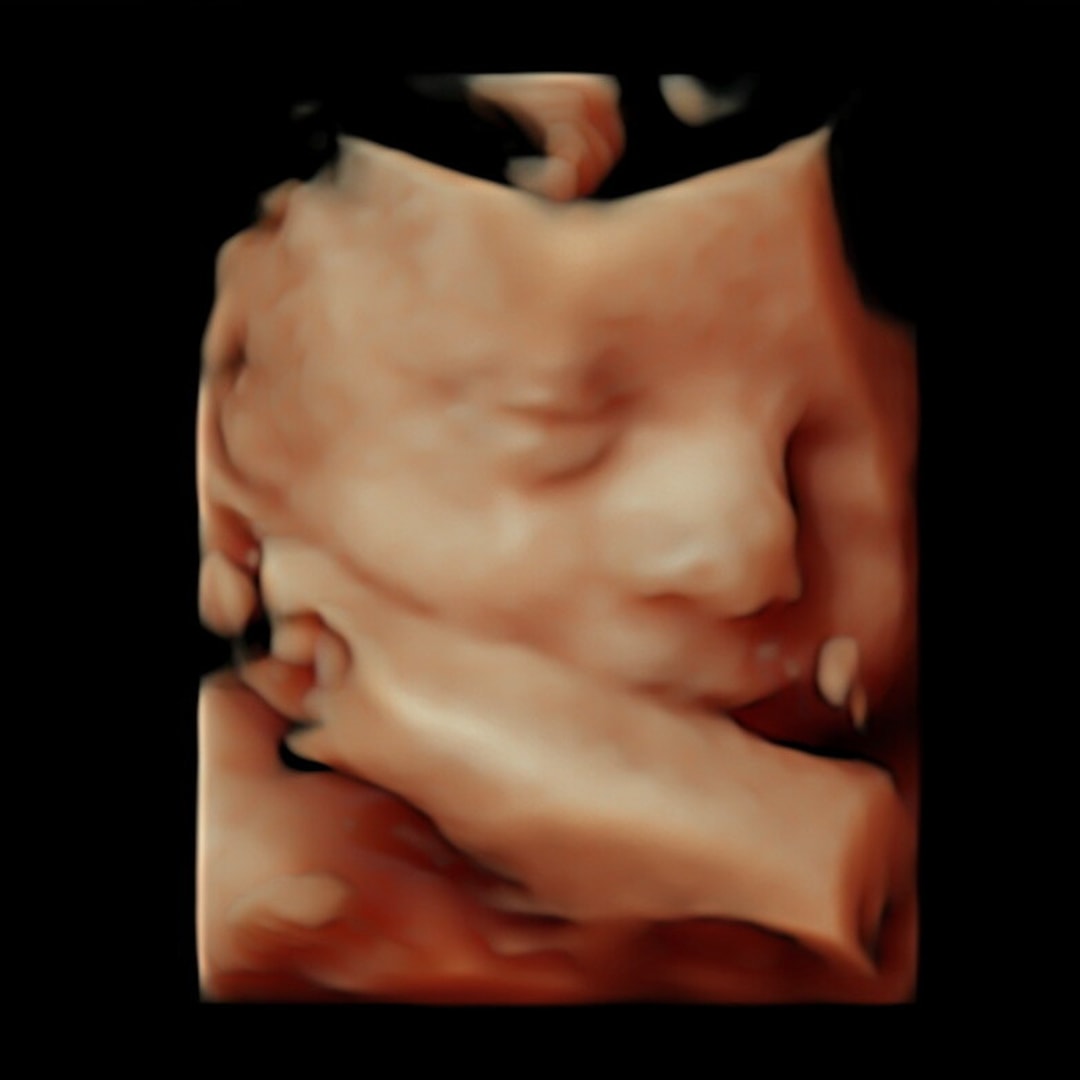 Photo shared by Alexis for their Babylist baby registry.