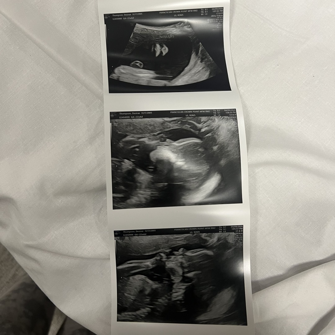 Photo shared by Desirae for their Babylist baby registry.