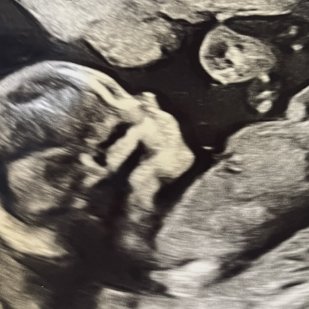 Photo shared by Amber for their Babylist baby registry.