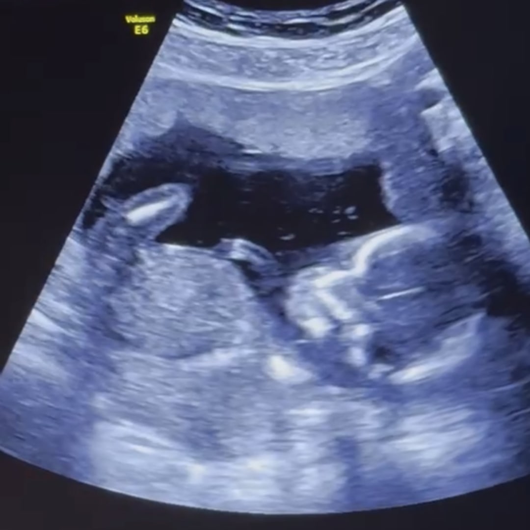Photo shared by Gianna for their Babylist baby registry.