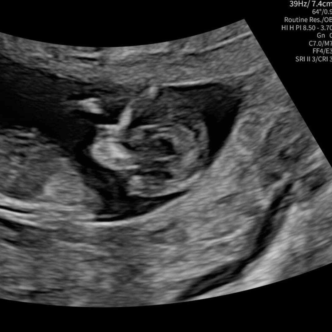 Photo shared by Baby for their Babylist baby registry.